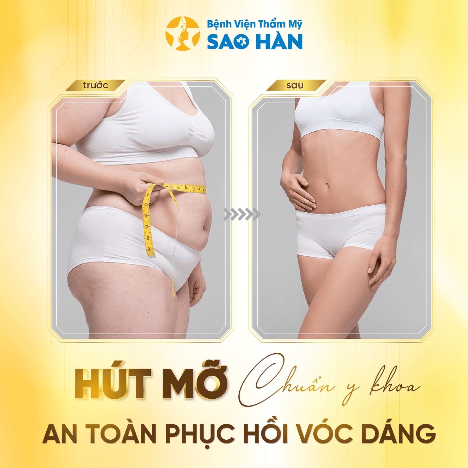 Hút mỡ-03